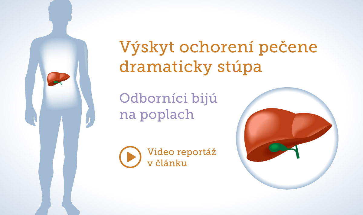 Výskyt chorôb pečene dramaticky stúpa. Pomôže Pestrec